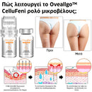 Oveallgo™ | Εξαλείψτε την κυτταρίτιδα και τη χαλάρωση του δέρματος σε 7 ημέρες (1+1 ΔΩΡΕΑΝ)