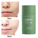 GreenStick 2.0™ | Η πιο αποτελεσματική μάσκα για χωρίς πόρους και άψογο δέρμα (1+1 ΔΩΡΕΑΝ)
