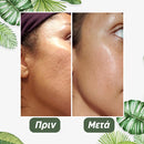 GreenStick 2.0™ | Η πιο αποτελεσματική μάσκα για χωρίς πόρους και άψογο δέρμα (1+1 ΔΩΡΕΑΝ)