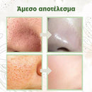 GreenStick 2.0™ | Η πιο αποτελεσματική μάσκα για χωρίς πόρους και άψογο δέρμα (1+1 ΔΩΡΕΑΝ)