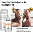 Oveallgo™ | Εξαλείψτε την κυτταρίτιδα και τη χαλάρωση του δέρματος σε 7 ημέρες (1+1 ΔΩΡΕΑΝ)
