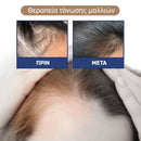MEDix™ | Κλινικά αποδεδειγμένο ότι ενισχύει την ανάπτυξη των μαλλιών σας (1+1 ΔΩΡΕΑΝ)
