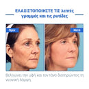 JAYSUING™ | Γυρίστε πίσω το ρολόι της ηλικίας στο πρόσωπό σας (1+1 ΔΩΡΕΑΝ)