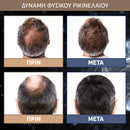 MEDix™ | Κλινικά αποδεδειγμένο ότι ενισχύει την ανάπτυξη των μαλλιών σας (1+1 ΔΩΡΕΑΝ)