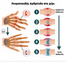 Perfectx™ | Μια ολιστική προσέγγιση για την αντιμετώπιση των ενοχλήσεων των οστών και των αρθρώσεων (1+1 ΔΩΡΕΑΝ)