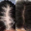 MEDix™ | Κλινικά αποδεδειγμένο ότι ενισχύει την ανάπτυξη των μαλλιών σας (1+1 ΔΩΡΕΑΝ)